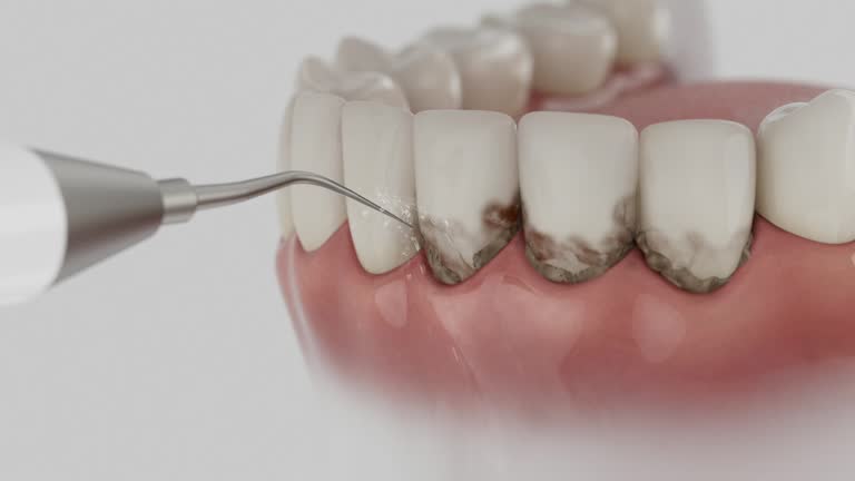 Reliable Tooth Extraction contractor in Rahway, NJ by Smile Center Dentistry